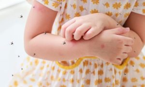 Dallas West Nile Alert