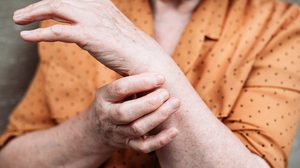 El Paso Expert Shares Tips To Lower Arthritis Risk