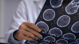 Man Diagnosed With Tapeworms In Brain