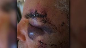 San Antonio Assault