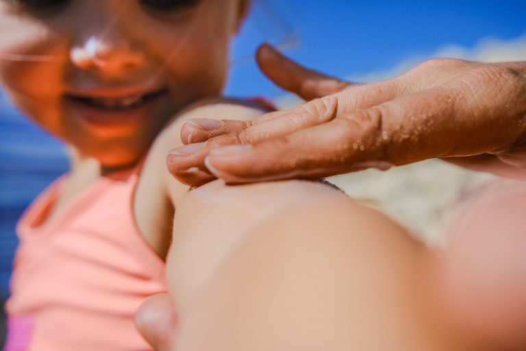 Treating Heat Rash This Summer