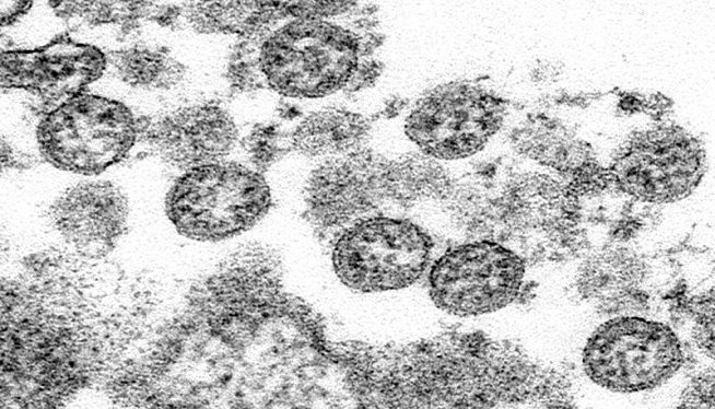 U S Funds Foreign Biolabs With Infectious Diseases