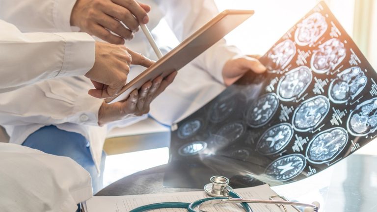 A State Professor Helps Veterans With Concussion Screening