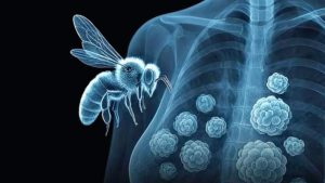 Bee Venom Shows Promise Against Breast Cancer