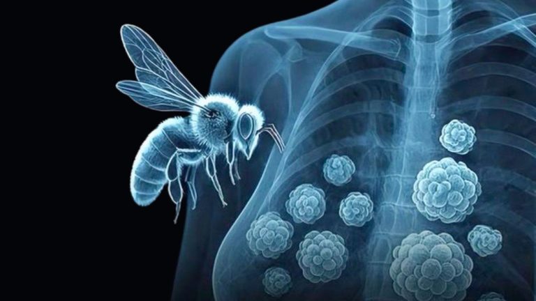 Bee Venom Shows Promise Against Breast Cancer