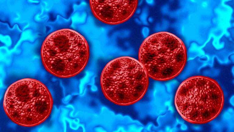Cyclospora Cases Rise In Florida