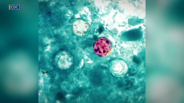 Cyclospora Cases Rise In Wake County
