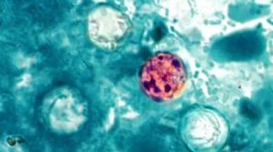 Cyclospora Outbreaks Rise