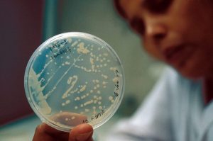 Cyclosporiasis Cases Rise In Michigan And Ohio