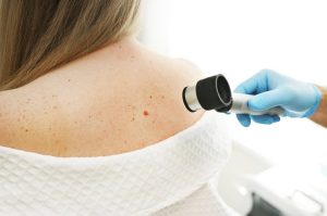 Dermatologist Shares Skin Cancer Warning Signs