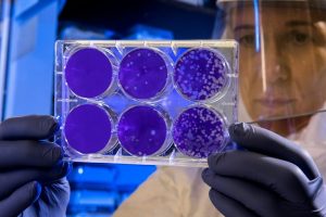 Indiana Sees Surge In Cyclosporiasis Cases