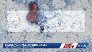 Iowa Cyclospora Outbreak Grows