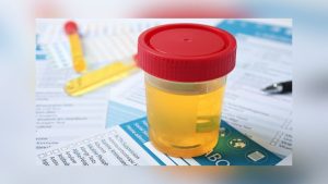 Labcorp To Pay 14 5M In Medicare Fraud Settlement