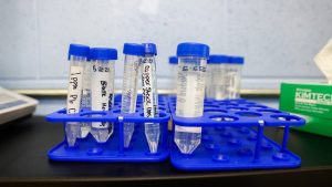Lead Exposure Decreases In Us