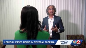 Leprosy Cases Rise In Central Florida