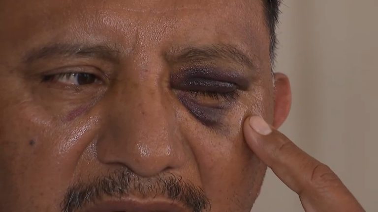 Long Beach Vendor Attacked