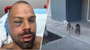 Man Attacked By Pit Bulls In Wynwood