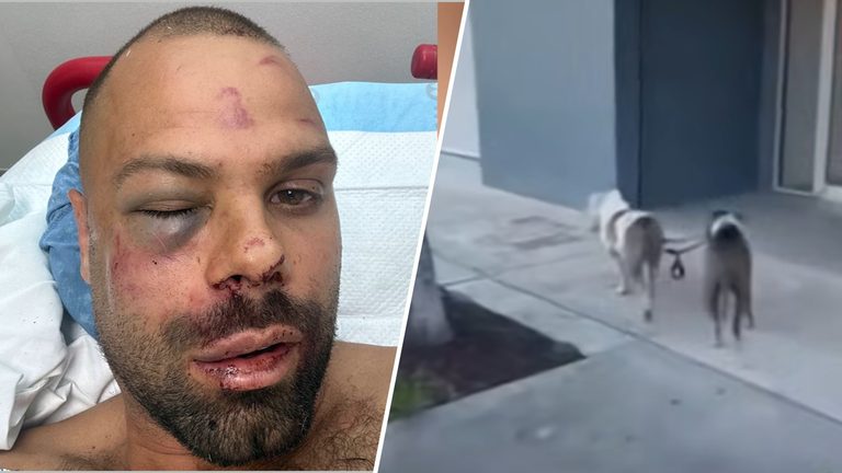 Man Attacked By Pit Bulls In Wynwood