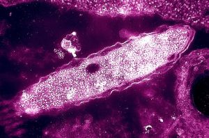 Nyc Legionnaires Disease Outbreak