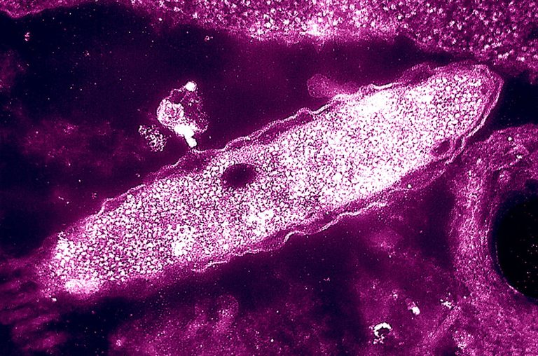 Nyc Legionnaires Disease Outbreak