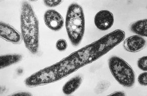 Nyc Legionnaires Outbreak Ends