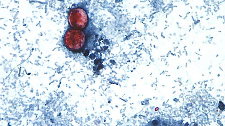 Parasite In Raw Produce Causes Illness