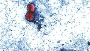Parasitic Infection Hits Kentucky