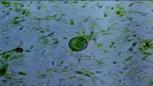 Schools Adjust Menus Amid Rise In Cyclosporiasis Cases