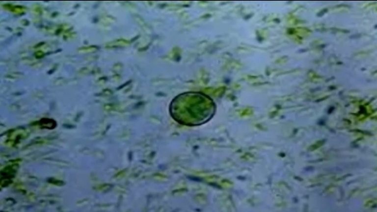 Schools Adjust Menus Amid Rise In Cyclosporiasis Cases
