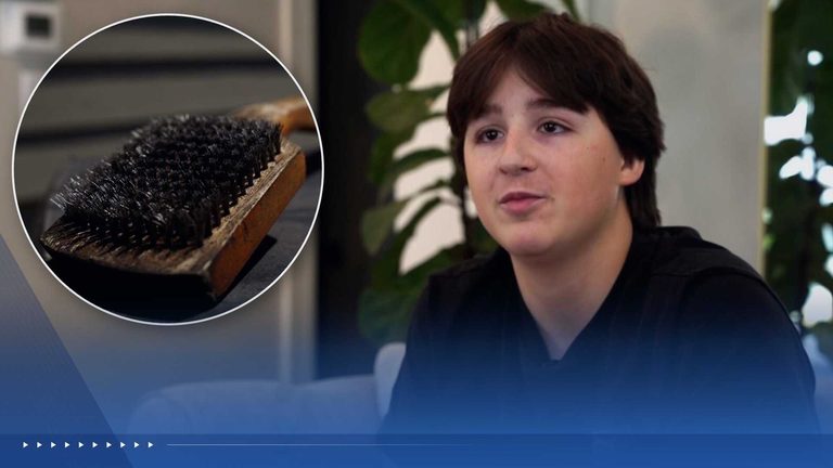 Teen Undergoes Emergency Surgery After Swallowing Grill Brush Bristle