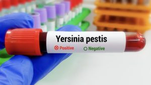 Utmb Researchers Develop Plague Vaccine