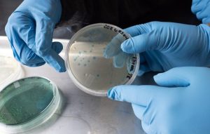 Vibrio Infections Rise In Chesapeake Bay