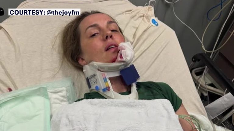 Bay Area Radio Host Warns Parents After E Bike Crash