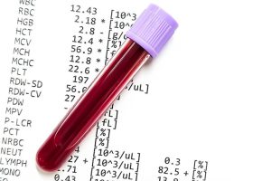 Blood Tests Are Easier Than Ever But Doctors Warn Results Can Be Misleading