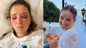 Bride Warns Of Risks Of Beauty Treatments