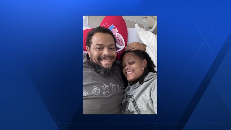 Couple S Love Shines Through Kidney Transplant Journey