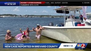 Florida Woman Warns Of Flesh Eating Bacteria