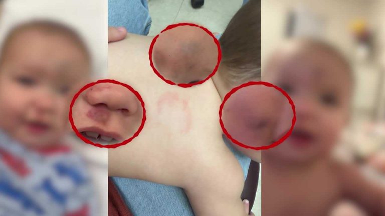 Holdenville Daycare Closes After 11 Month Old Injured On First Day
