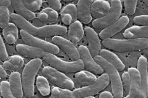 Marion County Resident Dies From Rare Vibrio Infection