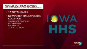 Measles Outbreak In Southern Iowa Reaches 17 Cases New Exposure Site Added