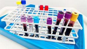 Measles Outbreaks Prompt Older Adults To Seek Immunity Tests