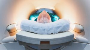 Midlife Brain Immune Shift Around Age 50 May Raise Dementia Risk