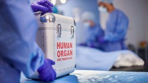 Organ Harvesting Probe