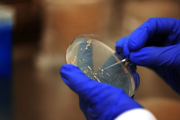 University Of Michigan Researchers Develop Yeast Based Universal Flu Vaccine