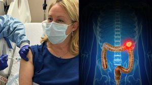 Vaccine Testing Underway For Colon Cancer