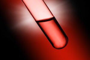 Fda Clears Roche S Elecsys Ptau217 Blood Test For Alzheimer S Detection In Adult