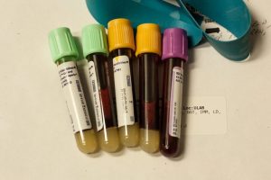 Fda Panel Backs Galleri Multi Cancer Blood Test But Raises Safety Concerns