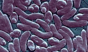 Fourth Florida Death This Year Linked To Vibrio Vulnificus Latest In Broward Cou