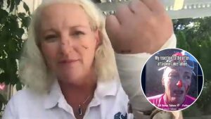 Lake Tahoe Swim Instructor Recovers After River Otter Bite Receives 38 Stitches