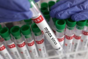 Mpox Case Confirmed In Bunia As Congo Battles Record Ebola Outbreak